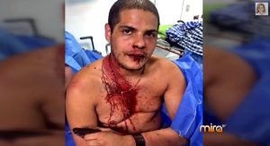 Según los estudiantes de la UCV, grupos paramilitares de Venezuela los atacaron dejando imágenes como ésta