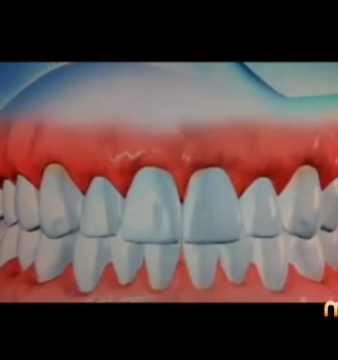 Muchos adultos en los Estados Unidos padecen de una u otra forma de esta enfermedad.